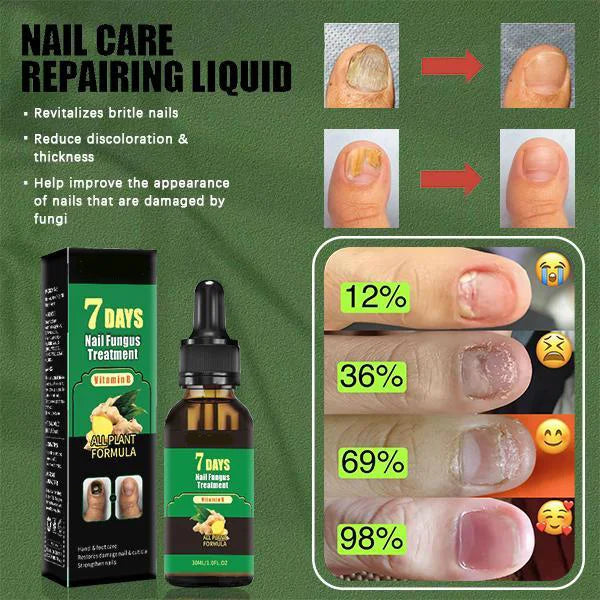 Nail treatment – Natural antifungal care