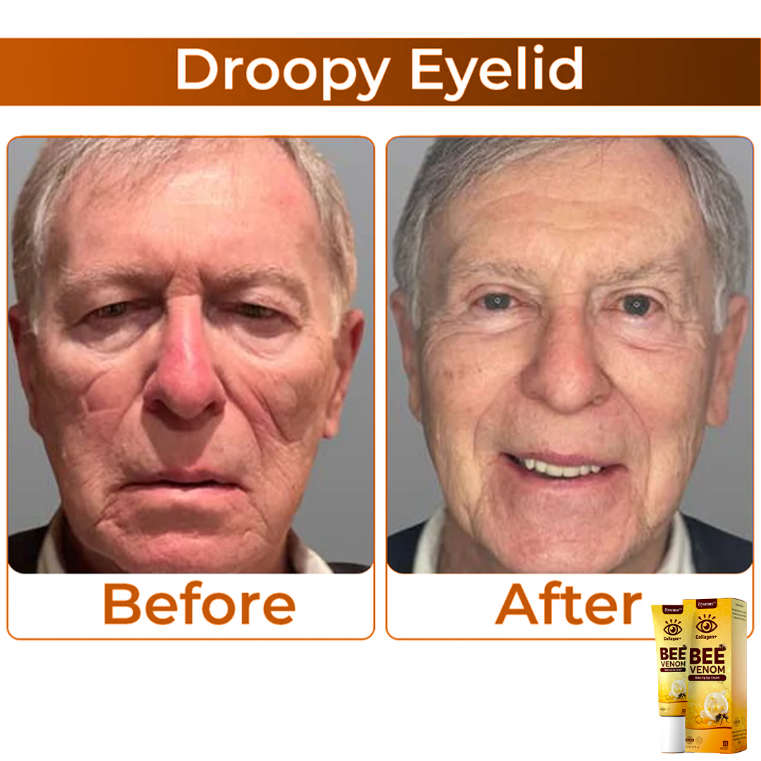 Veneno de abeja + Colágeno: Despierta tu mirada